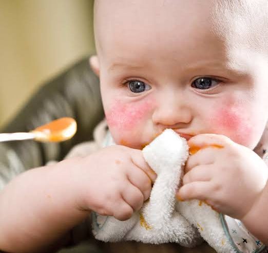 Bebekte Soya Alerjisi: Nedenleri, Belirtileri Ve Tedavisi